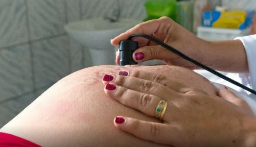 Bolsa Família reduz risco de morte materna em até 31%
